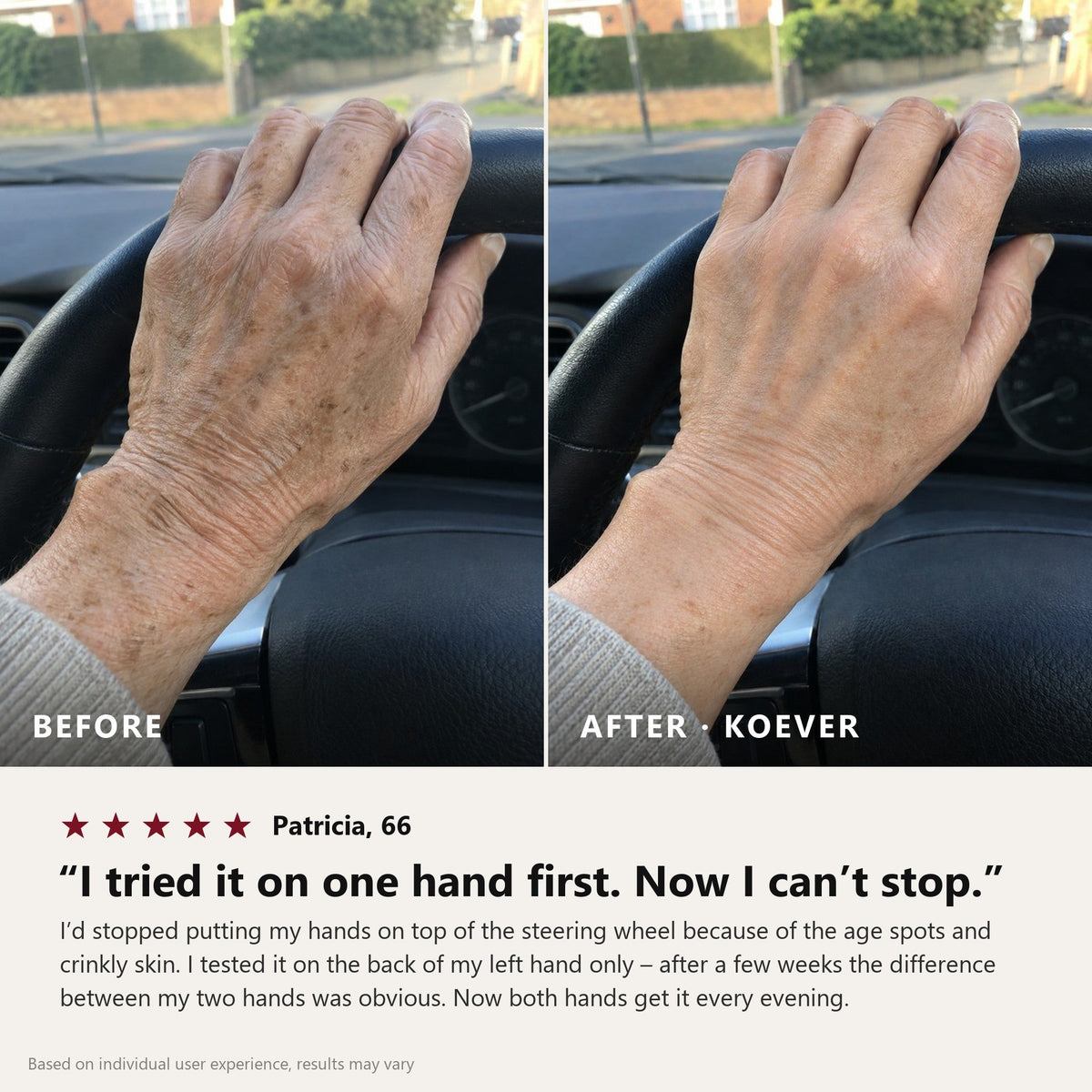 KOEVER Retinal Body Serum – avant apres mains