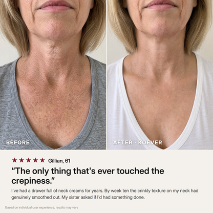 KOEVER Retinal Neck & Chest Serum