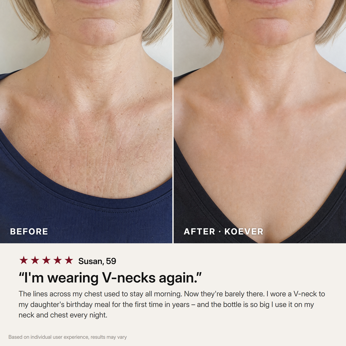KOEVER Retinal Neck & Chest Serum