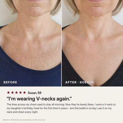KOEVER Retinal Neck & Chest Serum
