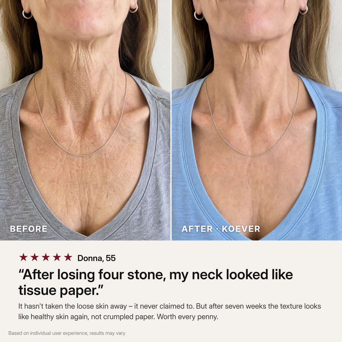 KOEVER Retinal Neck & Chest Serum