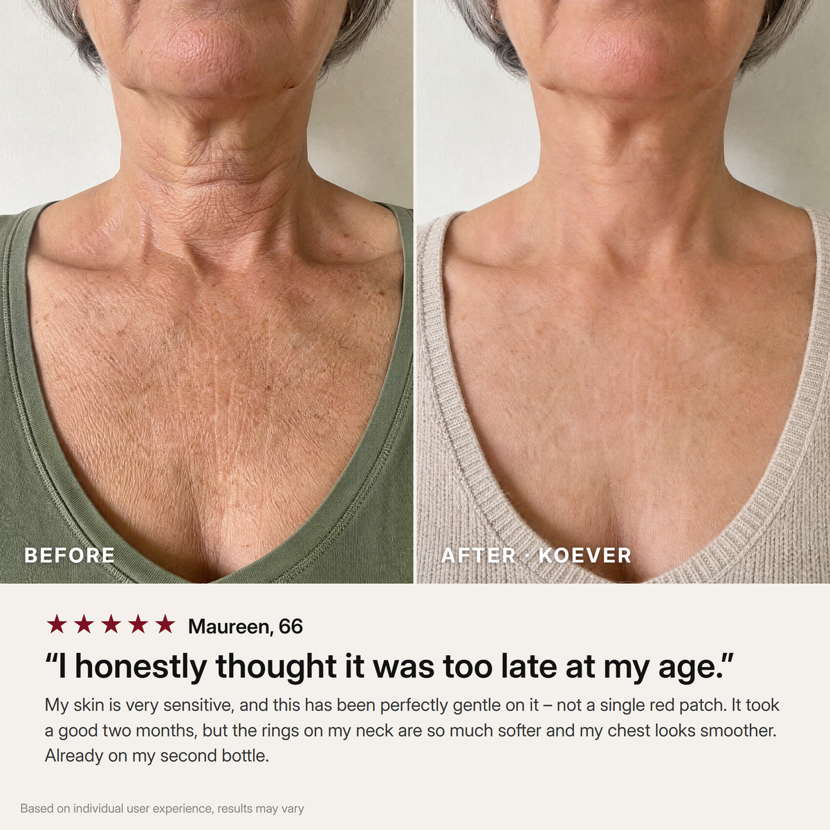 KOEVER Retinal Neck & Chest Serum