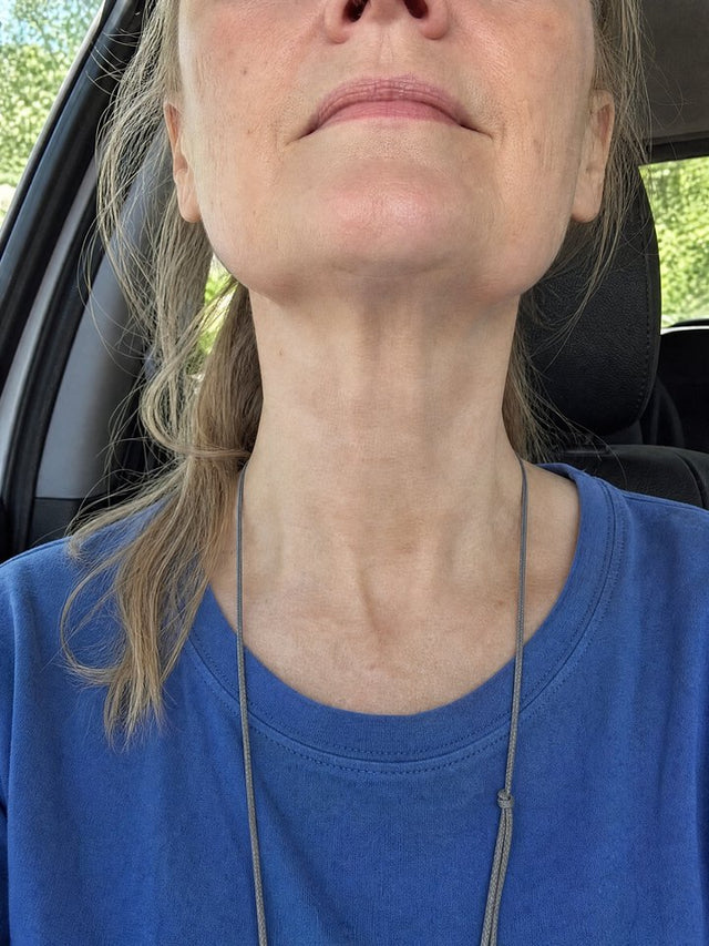 After 7 Weeks