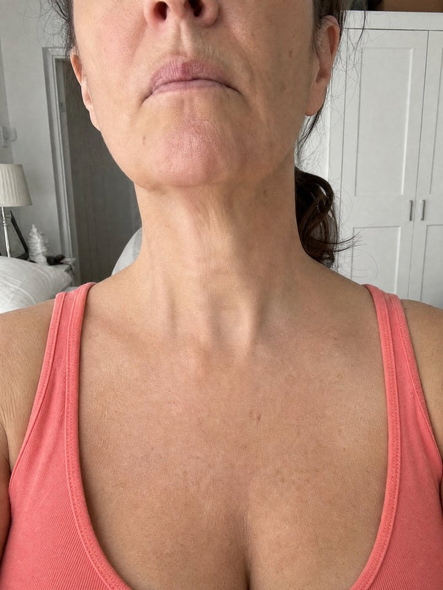 After 6 Weeks