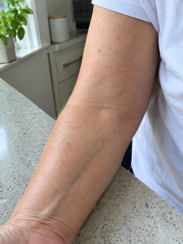 After 6 Weeks