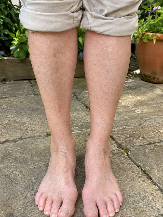 After 8 Weeks