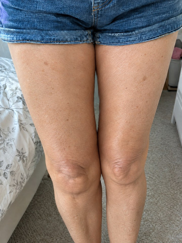 After 6 Weeks