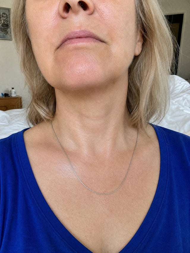 After 7 Weeks