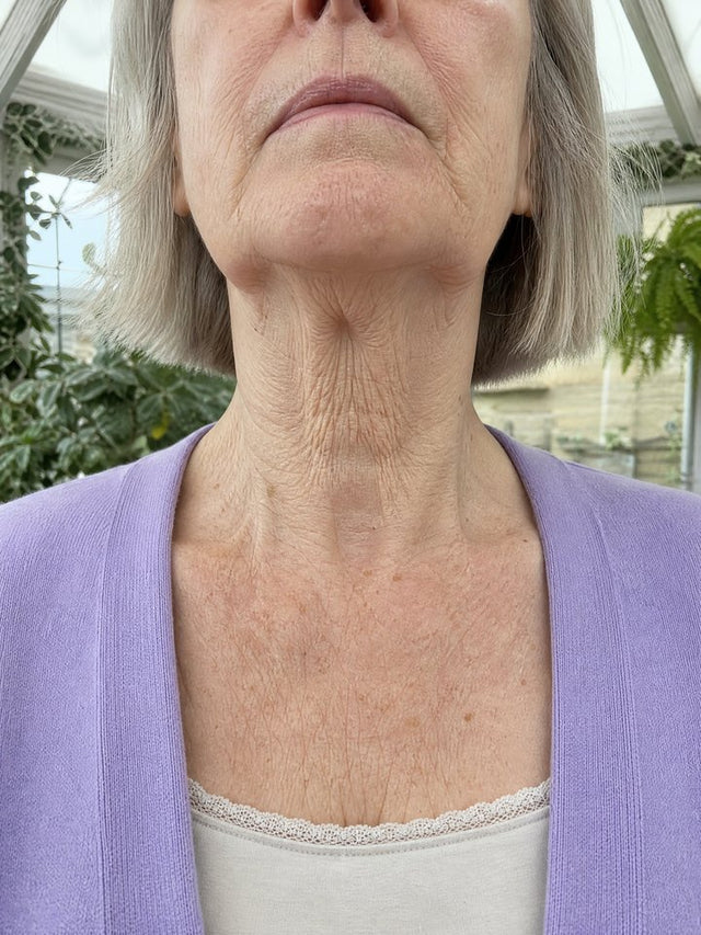 After 8 Weeks