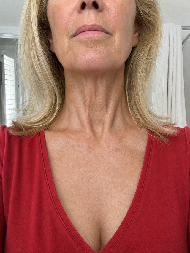 After 6 Weeks