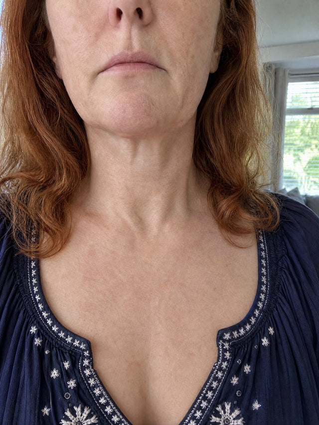 After 8 Weeks