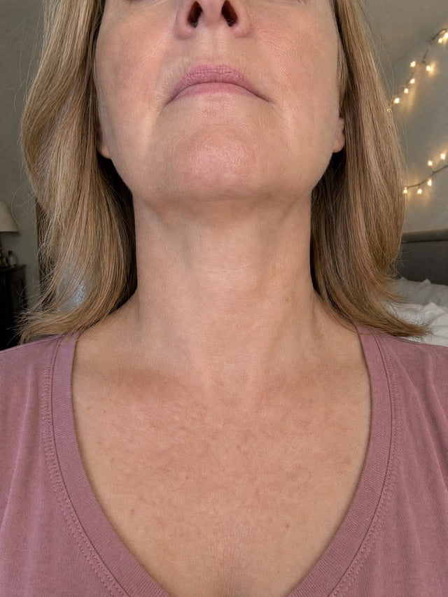 After 7 Weeks