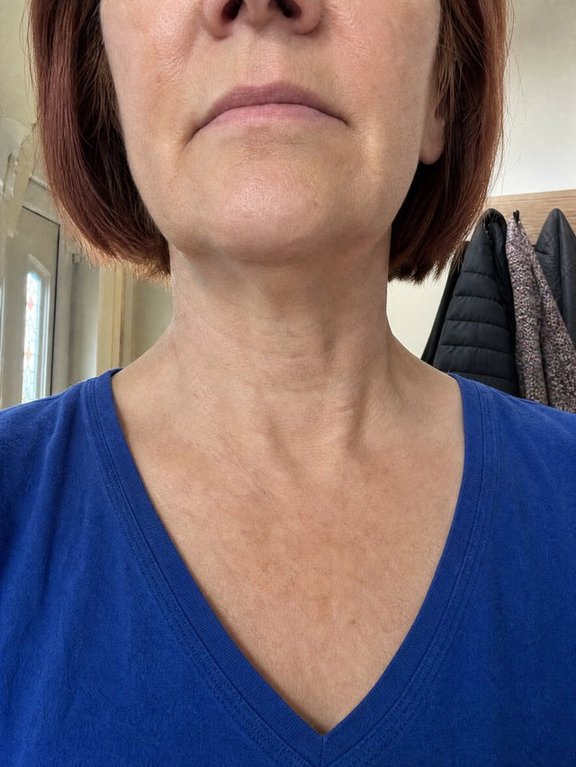 After 10 Weeks