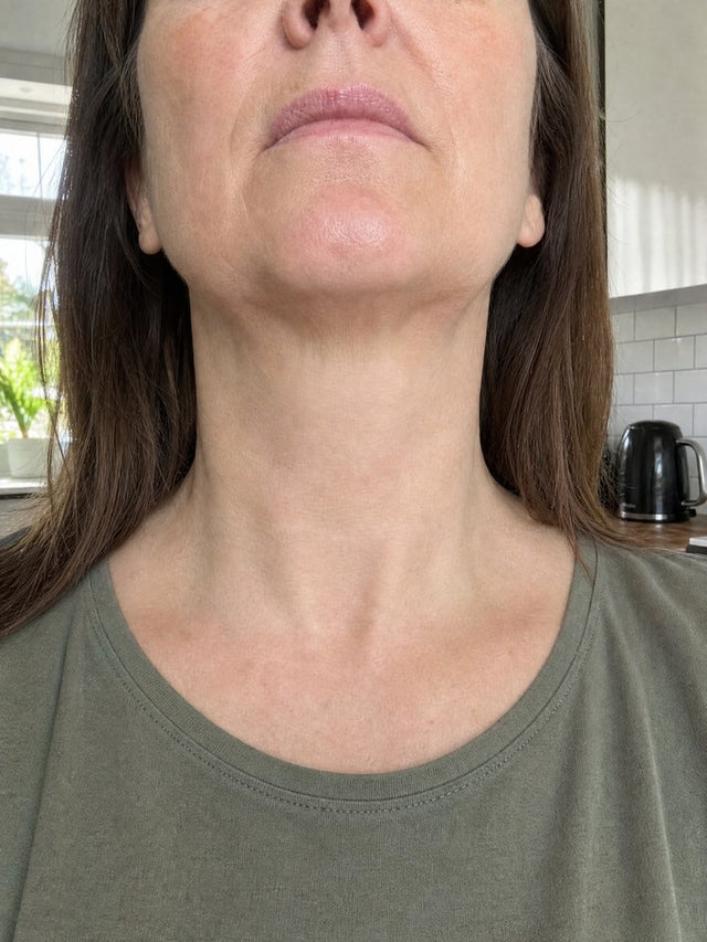 After 5 Weeks