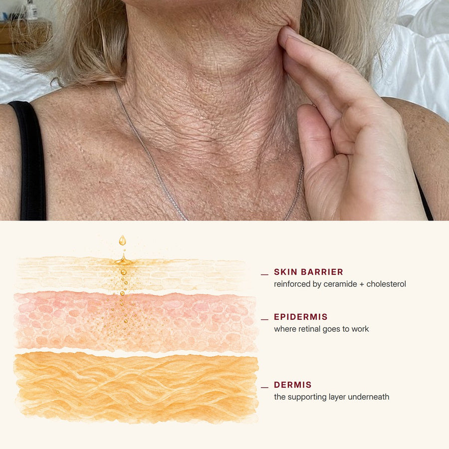 1. It's Built On Retinal – The Vitamin A Your Neck Can Actually Take