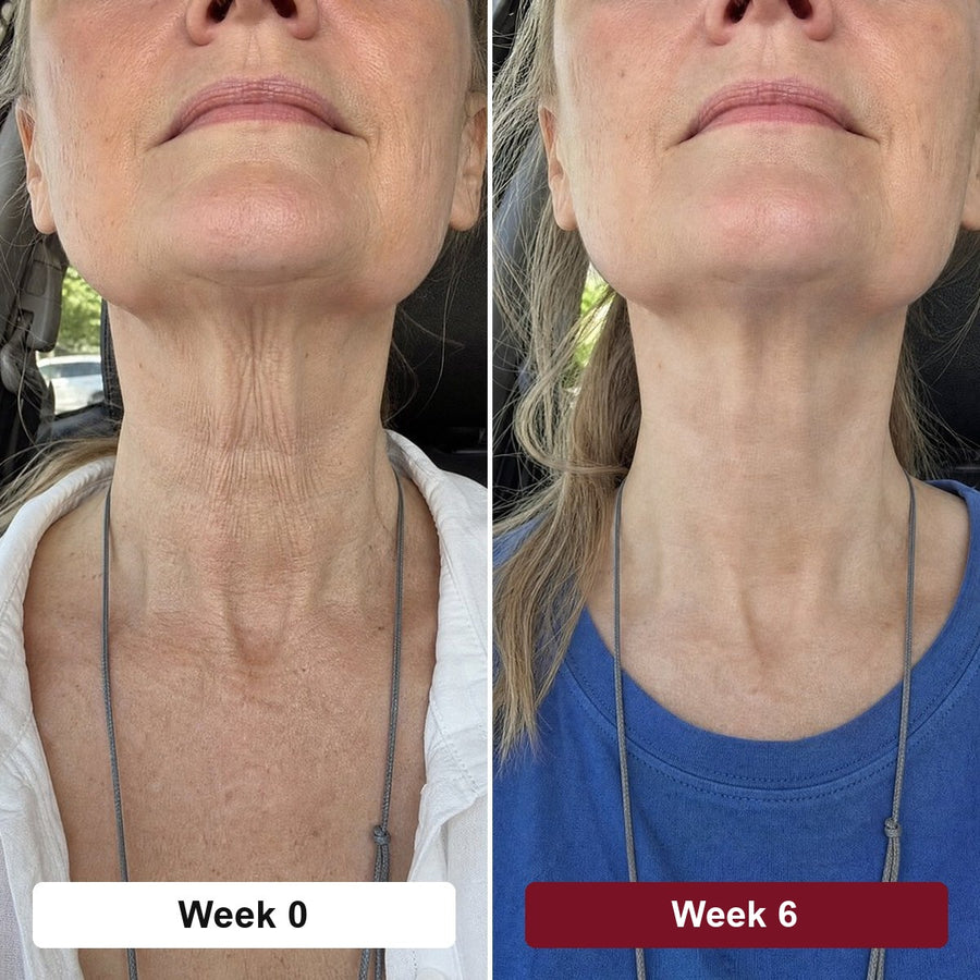 4. It's The Post-Weight-Loss Neck Serum Women Have Been Waiting For